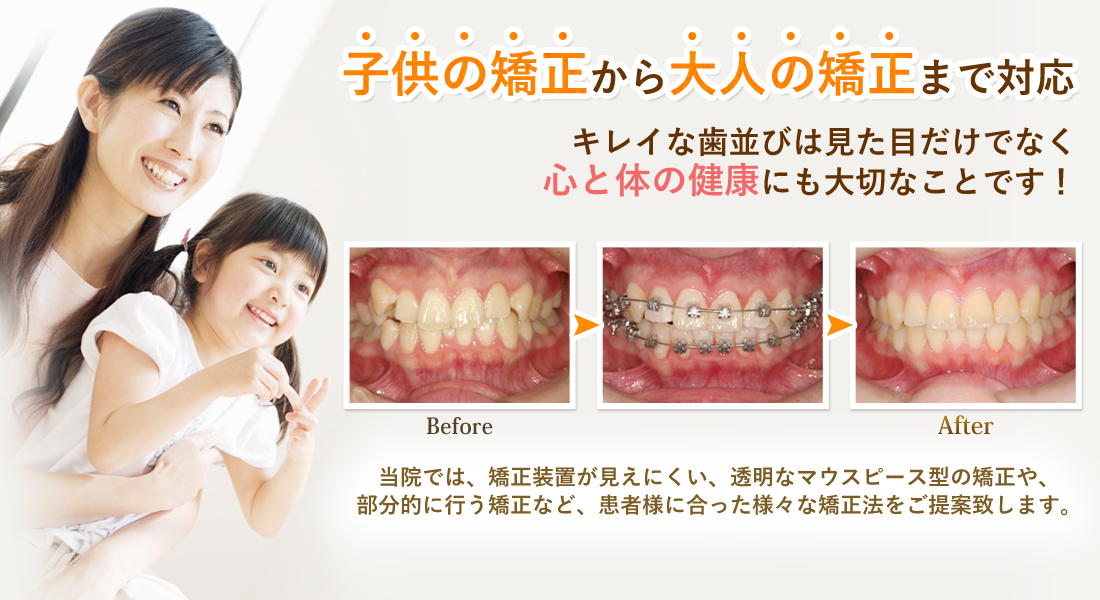 西宮市 歯科 歯医者 ケイ歯科クリニック 甲東園駅すぐ