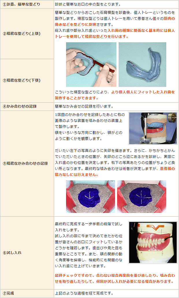 入れ歯製作の流れ