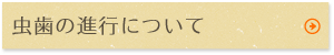 虫歯の進行について