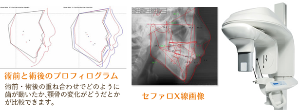 セファロX線撮影機器