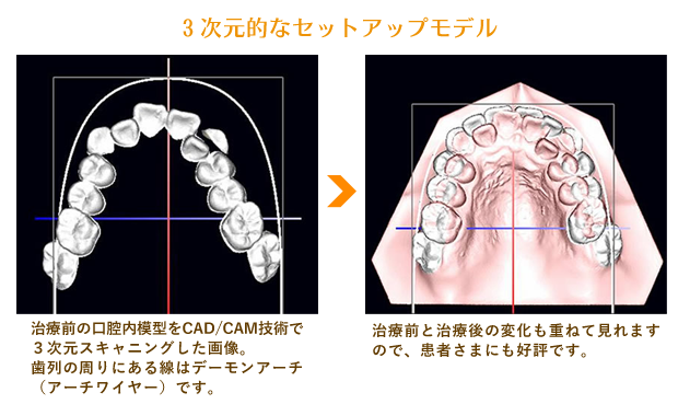 ３次元的なセットアップモデル