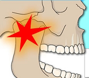 顎関節症について
