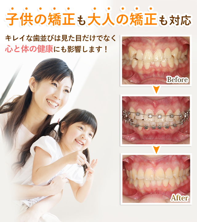 矯正歯科・小児矯正歯科対応のケイ歯科クリニック