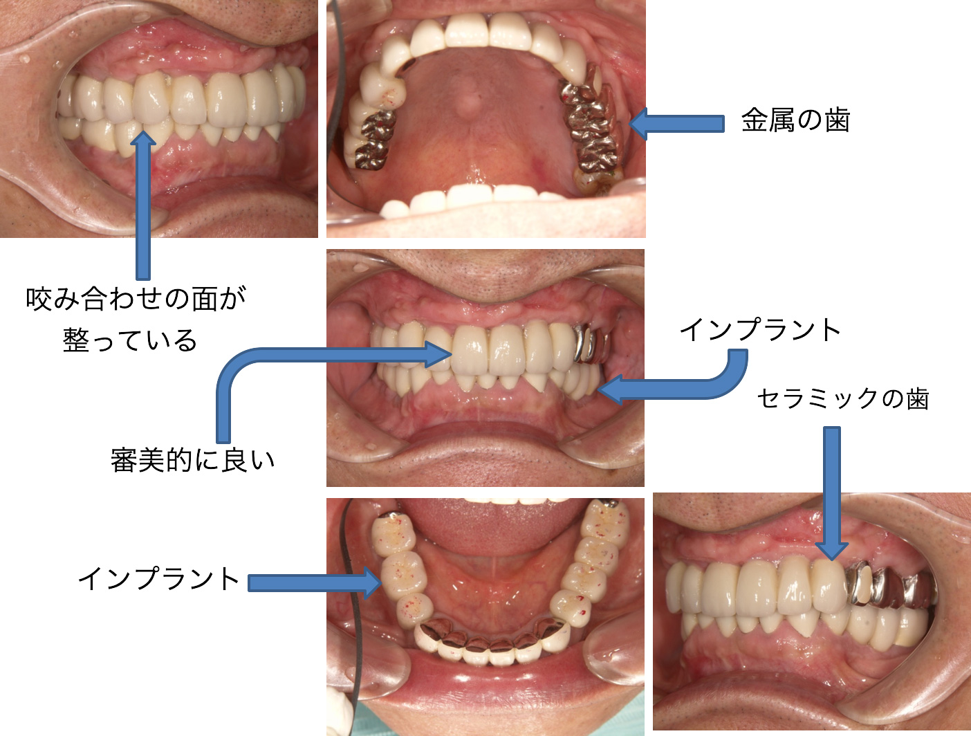 症例