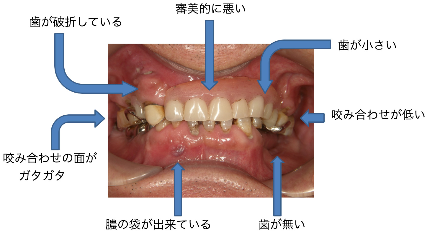 症例