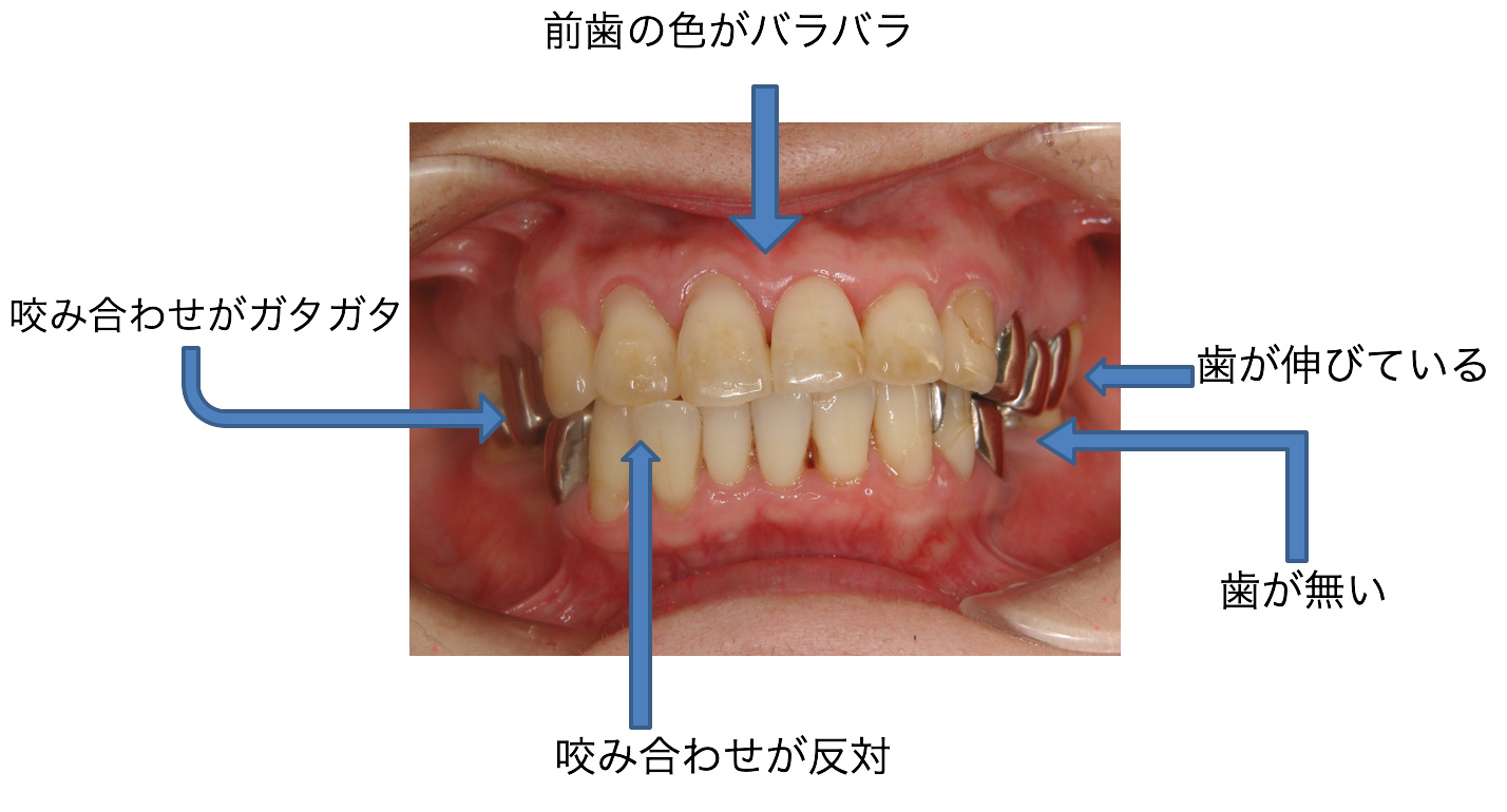 症例