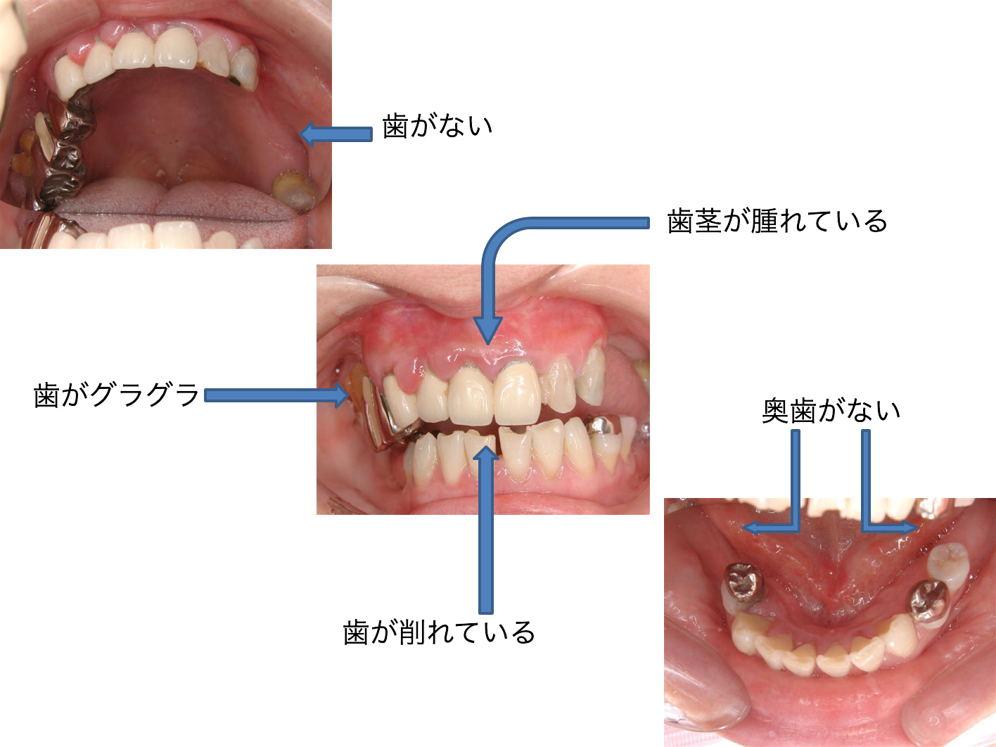 症例