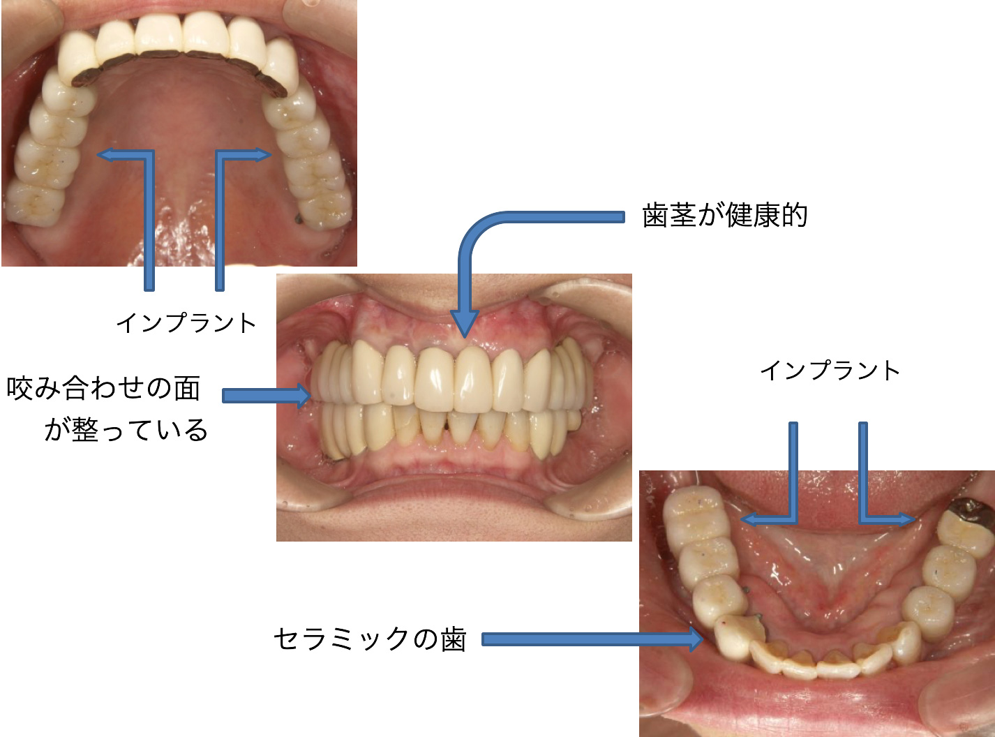 症例