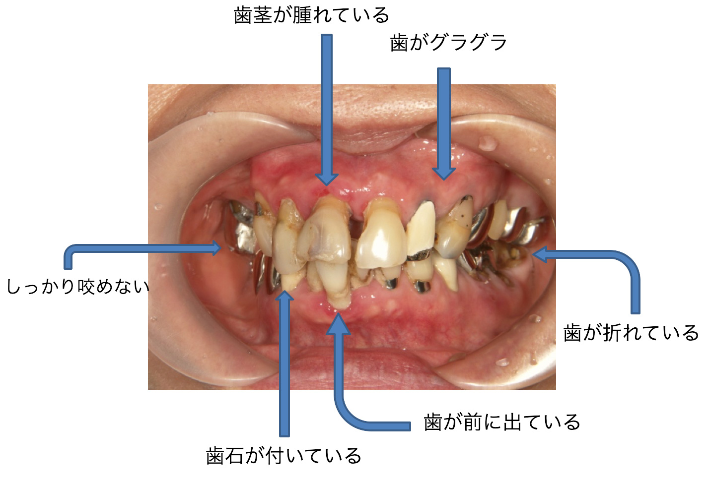 症例