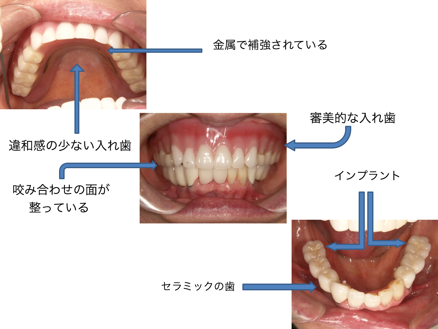 症例