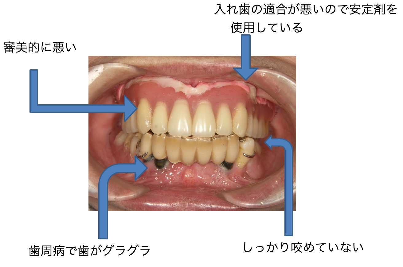 症例