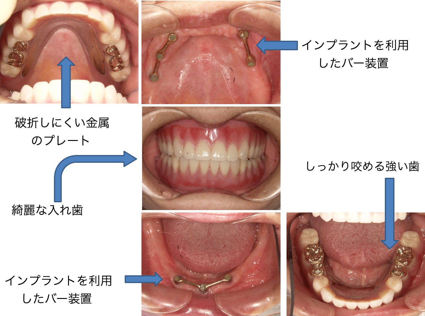 症例