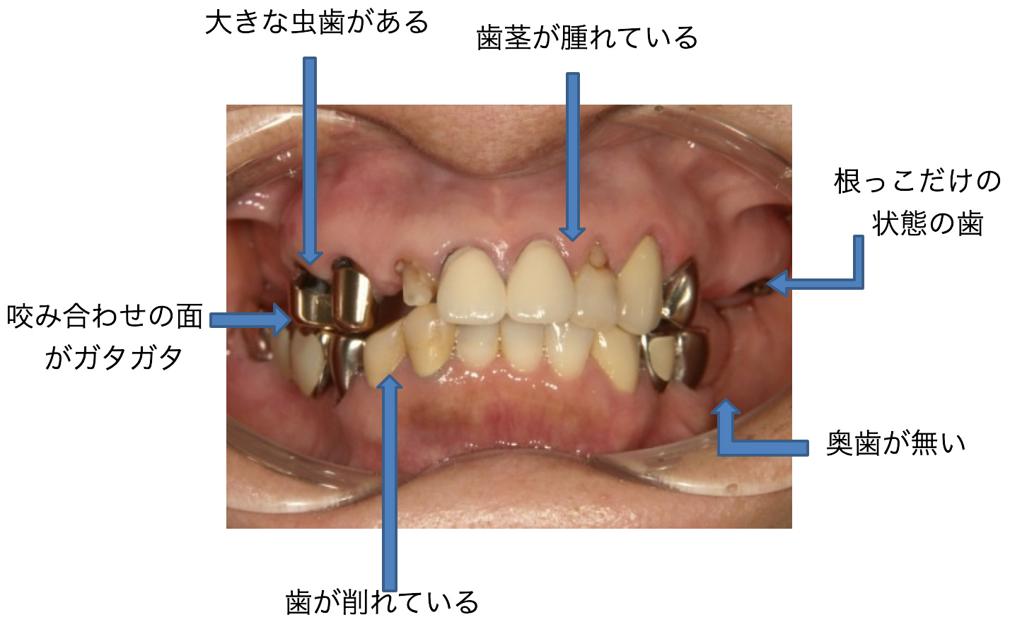 症例