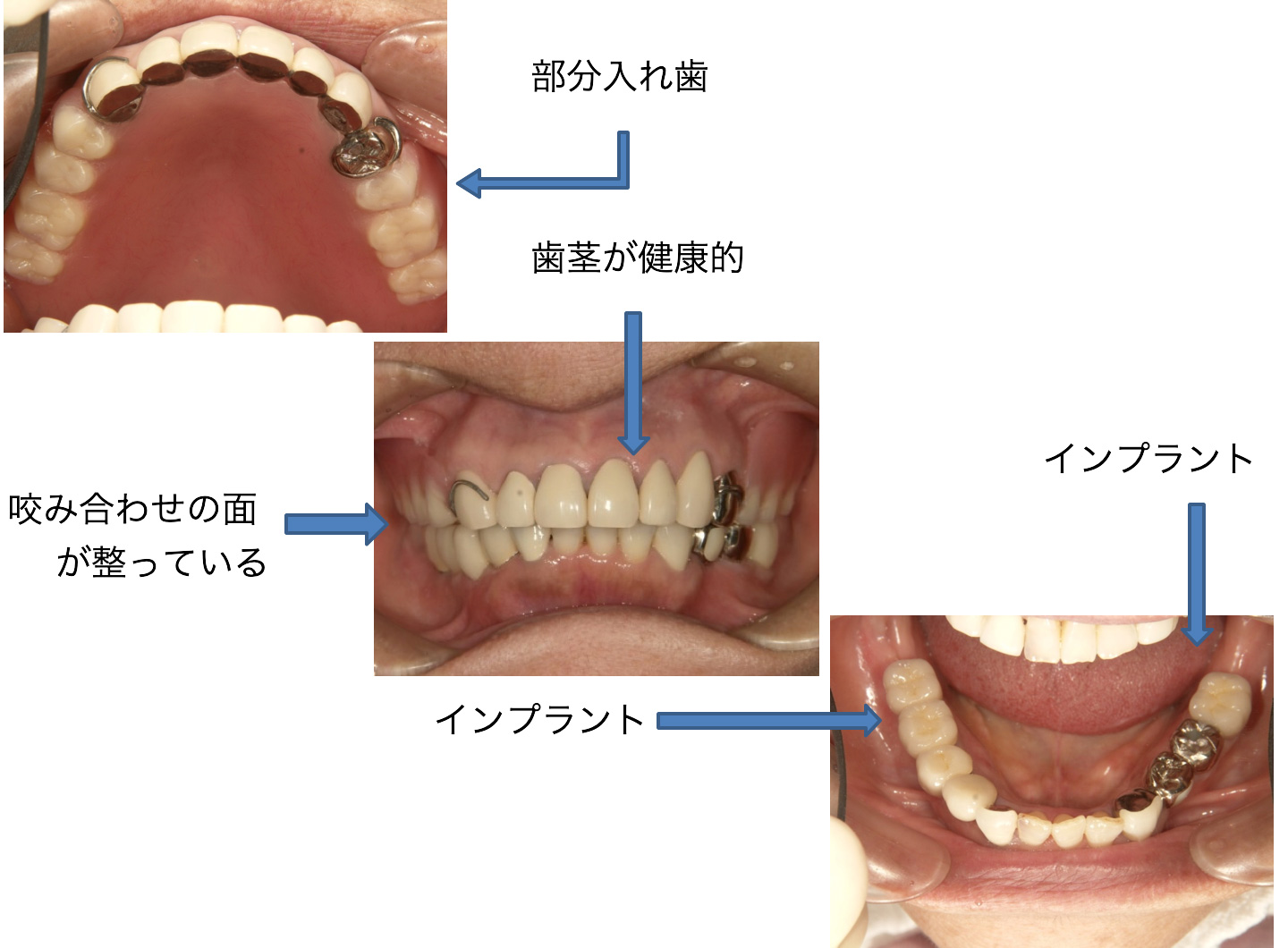 症例