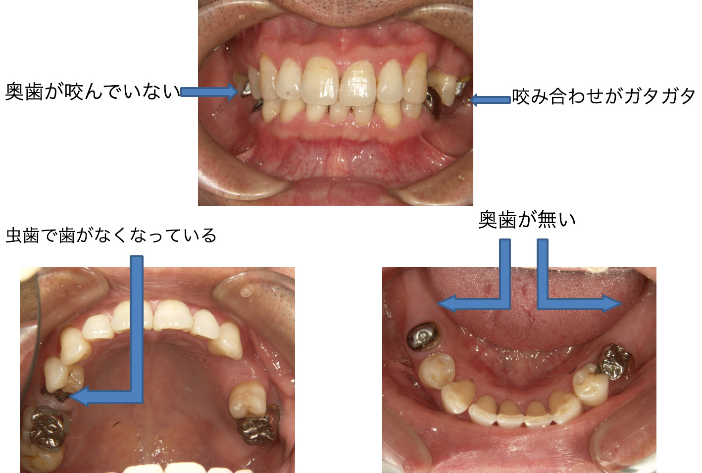 症例