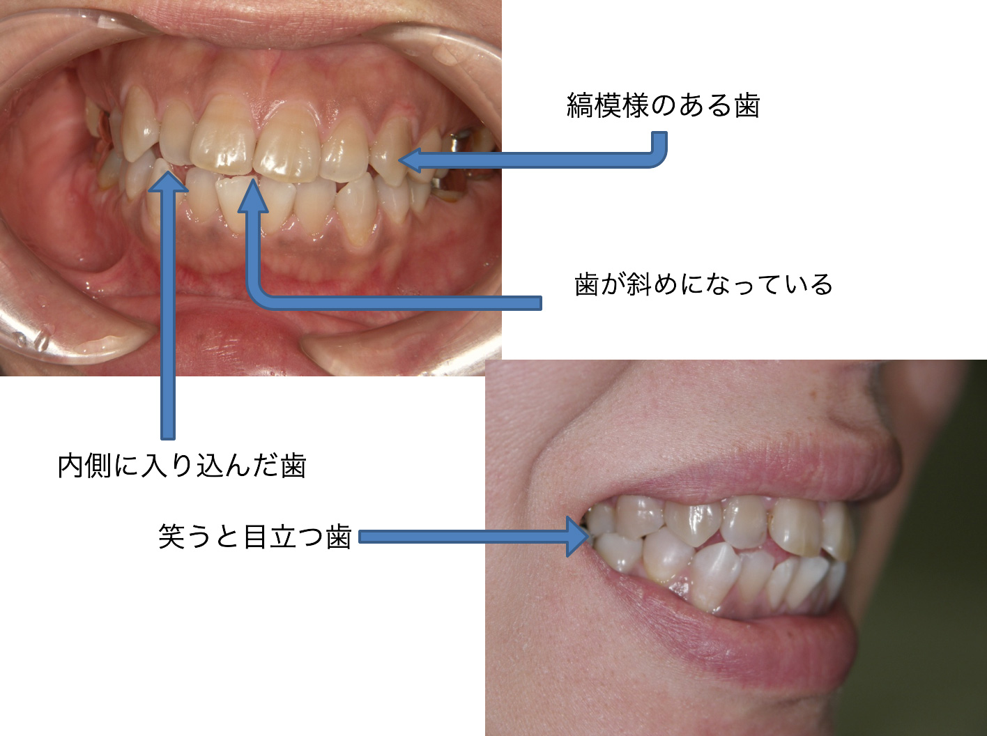 症例