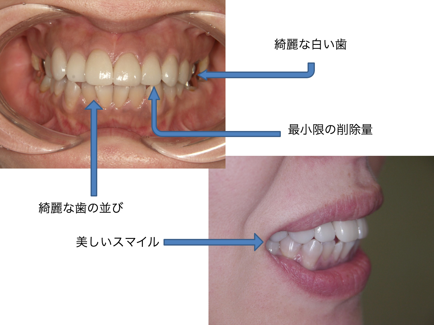 症例