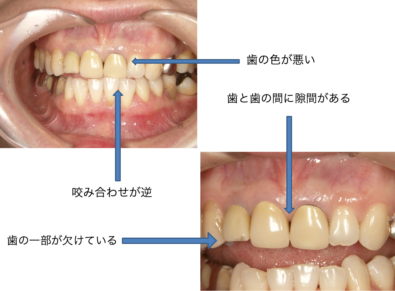 症例