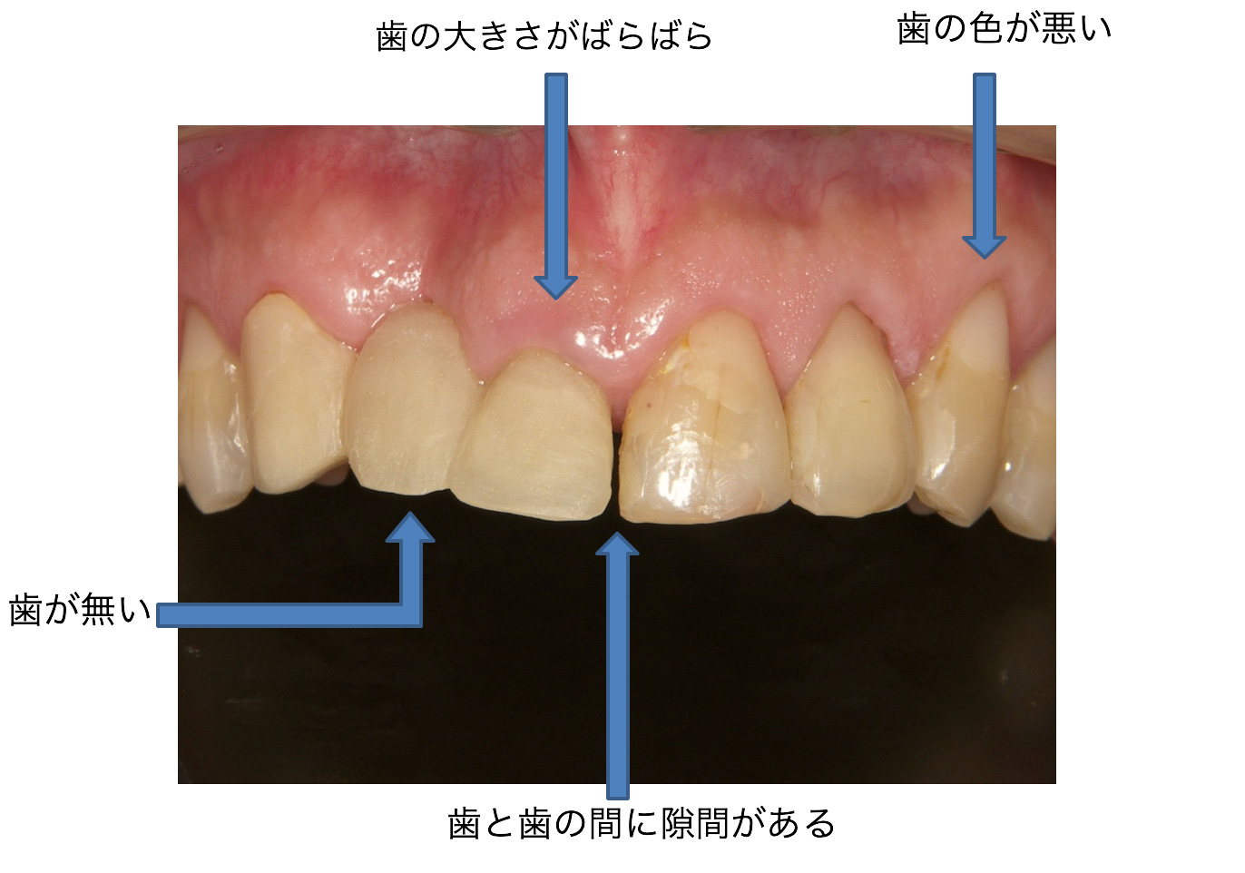 症例