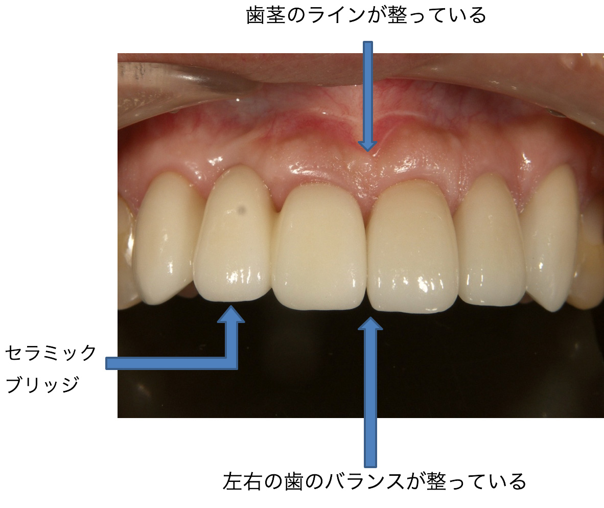 症例