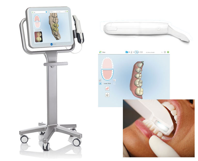 インビザライン専用口腔内スキャナー「iTero」