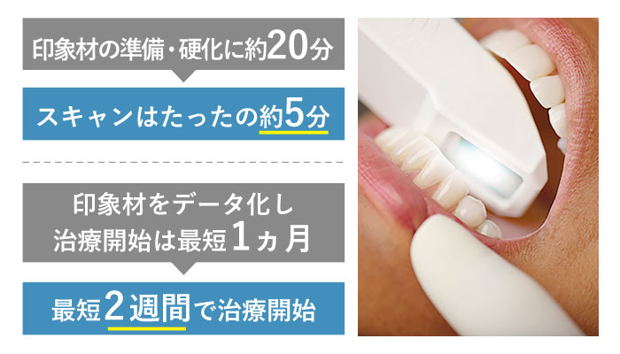 非常にスピーディー