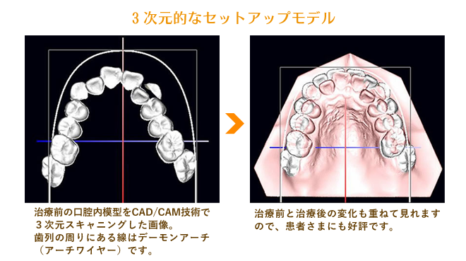 ３次元的なセットアップモデル